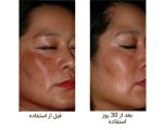 سرم نیاسینامید اوردینیری 30 میل - Image 2