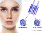 کاتریج نیدلینگ - Image 5