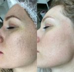 ژل کربوکسی کلینکر 500 میل